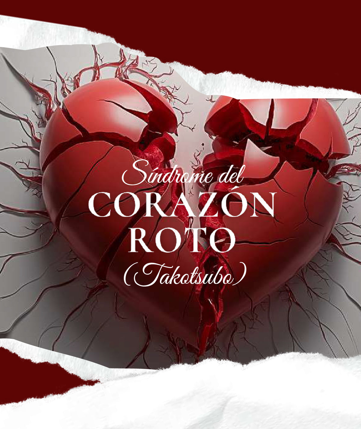 E-book Síndrome del Corazón Roto